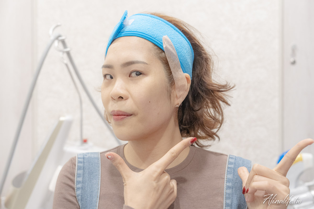 Z音波初體驗心得｜收緊有感、快又不痛！推薦台中佳思優醫美診所 @Alina 愛琳娜